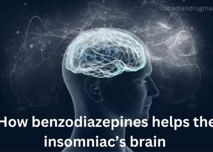 benzodiazepines for insomnia